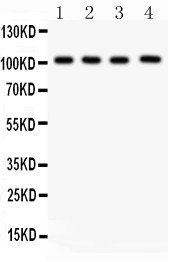 NRP1 / Neuropilin 1 Antibody - Neuropilin-1 antibody Western blot. All lanes: Anti Neuropilin-1 at 0.5 ug/ml. Lane 1: U87 Whole Cell Lysate at 40 ug. Lane 2: A549 Whole Cell Lysate at 40 ug. Lane 3: Human Placenta Tissue Lysate at 50 ug. Lane 4: Rat Cardiac Muscle Tissue Lysate at 50 ug. Predicted band size: 103 kD. Observed band size: 103 kD.