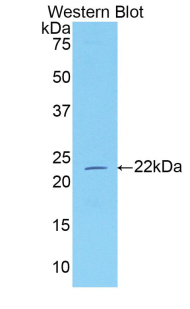 NRP1 / Neuropilin 1 Antibody - Western blot of recombinant NRP1 / Neuropilin 1.  This image was taken for the unconjugated form of this product. Other forms have not been tested.