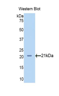 NRP1 / Neuropilin 1 Antibody - Western blot of recombinant NRP1 / Neuropilin 1.  This image was taken for the unconjugated form of this product. Other forms have not been tested.