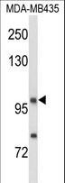 NRP1 / Neuropilin 1 Antibody - Western blot of NRP1 Antibody in MDA-MB435 cell line lysates (35 ug/lane). NRP1 (arrow) was detected using the purified antibody.