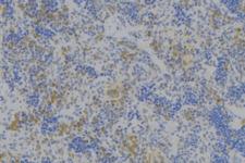 NRP1 / Neuropilin 1 Antibody - 1:100 staining human lymph node tissue by IHC-P. The sample was formaldehyde fixed and a heat mediated antigen retrieval step in citrate buffer was performed. The sample was then blocked and incubated with the antibody for 1.5 hours at 22°C. An HRP conjugated goat anti-rabbit antibody was used as the secondary.