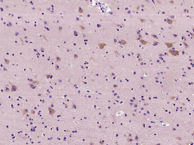 NRP1 / Neuropilin 1 Antibody - Immunochemical staining NRP1 in human brain with rabbit polyclonal antibody at 1:300 dilution, formalin-fixed paraffin embedded sections.