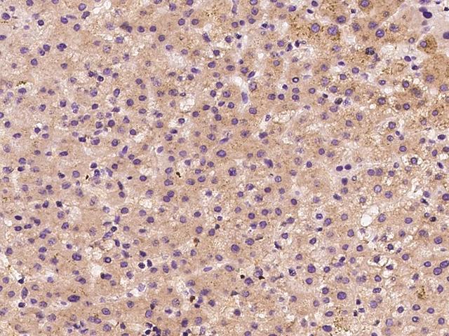 NRP1 / Neuropilin 1 Antibody - Immunochemical staining NRP1 in human liver with rabbit polyclonal antibody at 1:300 dilution, formalin-fixed paraffin embedded sections.