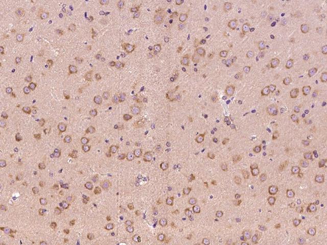 NRP1 / Neuropilin 1 Antibody - Immunochemical staining NRP1 in rat brain with rabbit polyclonal antibody at 1:300 dilution, formalin-fixed paraffin embedded sections.