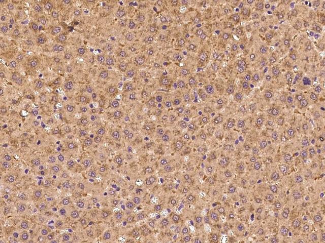 NRP1 / Neuropilin 1 Antibody - Immunochemical staining NRP1 in rat liver with rabbit polyclonal antibody at 1:300 dilution, formalin-fixed paraffin embedded sections.