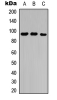 NRP2 / Neuropilin 2 Antibody - Western blot analysis of Neuropilin 2 expression in A549 (A); Raw264.7 (B); rat lung (C) whole cell lysates.