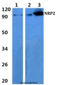 NRP2 / Neuropilin 2 Antibody - Western blot of NRP2 antibody at 1:500 dilution. Lane 1: A549 whole cell lysate. Lane 2: Raw264.7 whole cell lysate. Lane 3: The lung tissue of rat.