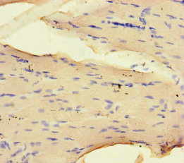 NRP2 / Neuropilin 2 Antibody - Immunohistochemistry of paraffin-embedded human skeletal muscle tissue at dilution of 1:100