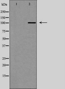 NRP2 / Neuropilin 2 Antibody - Western blot analysis of mouse brain lysate using NRP2 antibody. The lane on the left is treated with the antigen-specific peptide.