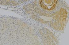 NRP2 / Neuropilin 2 Antibody - 1:100 staining human uterus tissue by IHC-P. The sample was formaldehyde fixed and a heat mediated antigen retrieval step in citrate buffer was performed. The sample was then blocked and incubated with the antibody for 1.5 hours at 22°C. An HRP conjugated goat anti-rabbit antibody was used as the secondary.