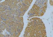 NRP2 / Neuropilin 2 Antibody - 1:100 staining human pancreas tissue by IHC-P. The sample was formaldehyde fixed and a heat mediated antigen retrieval step in citrate buffer was performed. The sample was then blocked and incubated with the antibody for 1.5 hours at 22°C. An HRP conjugated goat anti-rabbit antibody was used as the secondary.