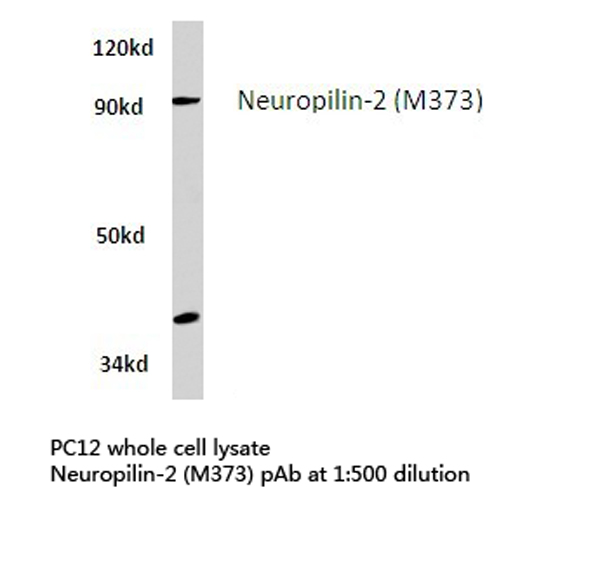 NRP2 / Neuropilin 2 Antibody - Western blot of Neuropilin-2 (M373) pAb in extracts from PC12 cells.