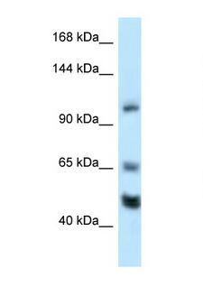 NRSF / REST Antibody - REST antibody Western blot of Mouse Heart lysate. Antibody concentration 1 ug/ml.  This image was taken for the unconjugated form of this product. Other forms have not been tested.