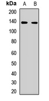 NRSF / REST Antibody - Western blot analysis of REST expression in MCF7 (A), HL60 (B) whole cell lysates.  