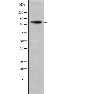 NRSF / REST Antibody - Western blot analysis of REST using COLO205 whole lysates.