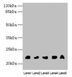 NRSN1 Antibody - Western blot All lanes: NRSN1 antibody at 3µg/ml Lane 1: Mouse stomach tissue Lane 2: Mouse thymus tissue Lane 3: Mouse gonadal tissue Lane 4: Hela whole cell lysate Lane 5: 293T whole cell lysate Secondary Goat polyclonal to rabbit IgG at 1/10000 dilution Predicted band size: 21 kDa Observed band size: 21 kDa