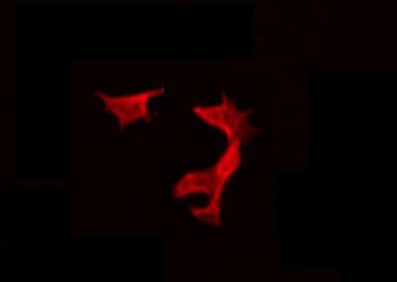 NRSN1 Antibody - Staining HeLa cells by IF/ICC. The samples were fixed with PFA and permeabilized in 0.1% Triton X-100, then blocked in 10% serum for 45 min at 25°C. The primary antibody was diluted at 1:200 and incubated with the sample for 1 hour at 37°C. An Alexa Fluor 594 conjugated goat anti-rabbit IgG (H+L) Ab, diluted at 1/600, was used as the secondary antibody.