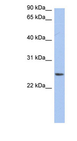 NRSN2 Antibody - NRSN2 antibody Western blot of THP-1 cell lysate. This image was taken for the unconjugated form of this product. Other forms have not been tested.