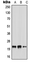 NRSN2 Antibody - Western blot analysis of NRSN2 expression in A549 (A); NIH3T3 (B); H9C2 (C) whole cell lysates.
