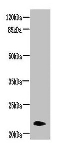 NRSN2 Antibody - Western blot All lanes: NRSN2 antibody at 3µg/ml + Mouse liver tissue Secondary Goat polyclonal to rabbit IgG at 1/10000 dilution Predicted band size: 22 kDa Observed band size: 22 kDa
