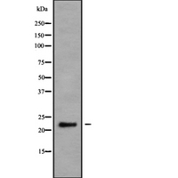 NRSN2 Antibody - Western blot analysis NRSN2 using K562 whole cells lysates