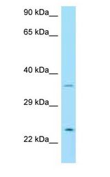 NRTN / Neurturin Antibody - NRTN / Neurturin antibody Western Blot of THP-1.  This image was taken for the unconjugated form of this product. Other forms have not been tested.