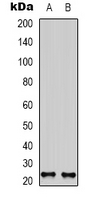 NRTN / Neurturin Antibody - Western blot analysis of Neurturin expression in K562 (A); L929 (B) whole cell lysates.