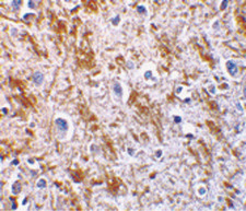 NRTN / Neurturin Antibody - Immunohistochemistry of neurturin in human brain tissue with neurturin antibody at 5 ug/ml.