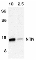NRTN / Neurturin Antibody - Western blot of NTN in HeLa cell lysate containing 10 or 2.5 ng of full length recombinant NTN with anti-neuturin at 1:500.