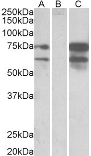 NRXN1 / Neurexin 1 Antibody - HEK293 lysate (10ug protein in RIPA buffer) overexpressing Human NRXN1 with DYKDDDDK tag probed with NRXN1 / Neurexin 1 antibody(0.5ug/ml) in Lane A and probed with anti- DYKDDDDK Tag (1/3000) in lane C. Mock-transfected HEK293 probed with NRXN1 / Neurexin 1 antibody(1mg/ml) in Lane B. Detected by chemiluminescence.
