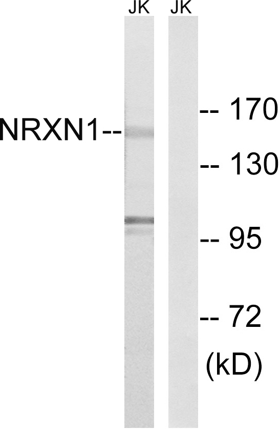 NRXN1 / Neurexin 1 Antibody - Western blot analysis of lysates from Jurkat cells, using NRXN1 Antibody. The lane on the right is blocked with the synthesized peptide.