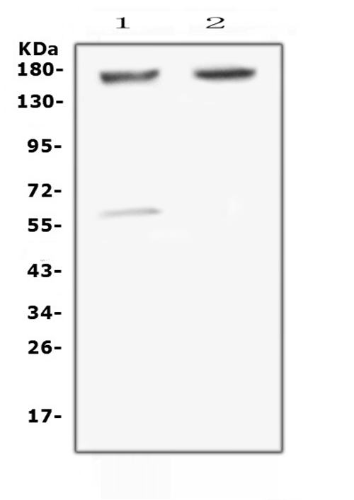 NRXN1 / Neurexin 1 Antibody - Western blot analysis of Neurexin 1 using anti-Neurexin 1 antibody. Electrophoresis was performed on a 5-20% SDS-PAGE gel at 70V (Stacking gel) / 90V (Resolving gel) for 2-3 hours. The sample well of each lane was loaded with 50ug of sample under reducing conditions. Lane 1: human U-87MG whole cell lysates, Lane 2: human SHG-4 whole cell lysates. After Electrophoresis, proteins were transferred to a Nitrocellulose membrane at 150mA for 50-90 minutes. Blocked the membrane with 5% Non-fat Milk/ TBS for 1.5 hour at RT. The membrane was incubated with rabbit anti-Neurexin 1 antigen affinity purified polyclonal antibody at 0.5 µg/mL overnight at 4°C, then washed with TBS-0.1% Tween 3 times with 5 minutes each and probed with a goat anti-rabbit IgG-HRP secondary antibody at a dilution of 1:10000 for 1.5 hour at RT. The signal is developed using an Enhanced Chemiluminescent detection (ECL) kit with Tanon 5200 system. A specific band was detected for Neurexin 1 at approximately 170KD. The expected band size for Neurexin 1 is at 162KD.