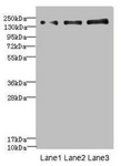 NRXN1 / Neurexin 1 Antibody - Western blot All Lanes: NRXN1antibody at 1.57ug/ml Lane 1: Jurkat whole cell lysate Lane 2: Hela whole cell lysate Lane 3: HepG-2 whole cell lysate Secondary Goat polyclonal to rabbit IgG at 1/10000 dilution Predicted band size: 162,165,170,47,16 kDa Observed band size: 162 kDa