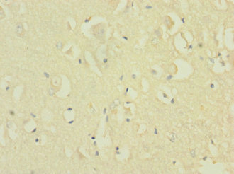 NRXN1 / Neurexin 1 Antibody - Immunohistochemistry of paraffin-embedded human brain tissue at dilution 1:100