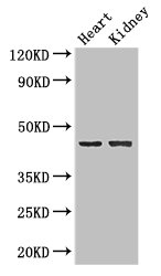 NRXN1 / Neurexin 1 Antibody - Western Blot Positive WB detected in:Mouse heart tissue,Mouse kidney tissue All Lanes: NRXN1 antibody at 2ug/ml Secondary Goat polyclonal to rabbit IgG at 1/50000 dilution Predicted band size: 47 kDa Observed band size: 47 kDa