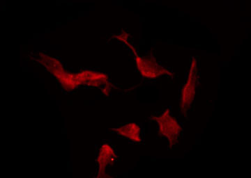NRXN1 / Neurexin 1 Antibody - Staining HeLa cells by IF/ICC. The samples were fixed with PFA and permeabilized in 0.1% Triton X-100, then blocked in 10% serum for 45 min at 25°C. The primary antibody was diluted at 1:200 and incubated with the sample for 1 hour at 37°C. An Alexa Fluor 594 conjugated goat anti-rabbit IgG (H+L) Ab, diluted at 1/600, was used as the secondary antibody.