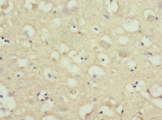 NRXN3 Antibody - Immunohistochemistry of paraffin-embedded human brain tissue at dilution 1:100