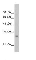 NSBP1 / HMGN5 Antibody - HepG2 Cell Lysate.  This image was taken for the unconjugated form of this product. Other forms have not been tested.