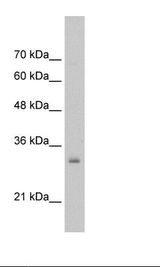 NSBP1 / HMGN5 Antibody - HepG2 Cell Lysate.  This image was taken for the unconjugated form of this product. Other forms have not been tested.