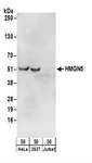 NSBP1 / HMGN5 Antibody - Detection of Human HMGN5 by Western Blot. Samples: Whole cell lysate (50 ug) from HeLa, 293T, and Jurkat cells. Antibodies: Affinity purified rabbit anti-HMGN5 antibody used for WB at 0.1 ug/ml. Detection: Chemiluminescence with an exposure time of 30 seconds.