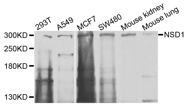 NSD1 Antibody - Western blot analysis of extracts of various cells.