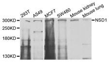 NSD1 Antibody - Western blot analysis of extracts of various cells.