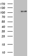 NSD3 / WHSC1L1 Antibody - HEK293T cells were transfected with the pCMV6-ENTRY control. (Left lane) or pCMV6-ENTRY WHSC1L1. (Right lane) cDNA for 48 hrs and lysed. Equivalent amounts of cell lysates. (5 ug per lane) were separated by SDS-PAGE and immunoblotted with anti-WHSC1L1. (1:2000)