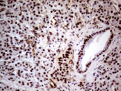 NSD3 / WHSC1L1 Antibody - Immunohistochemical staining of paraffin-embedded Human pancreas tissue within the normal limits using anti-WHSC1L1 mouse monoclonal antibody. (Heat-induced epitope retrieval by 1mM EDTA in 10mM Tris buffer. (pH8.5) at 120°C for 3 min. (1:500)