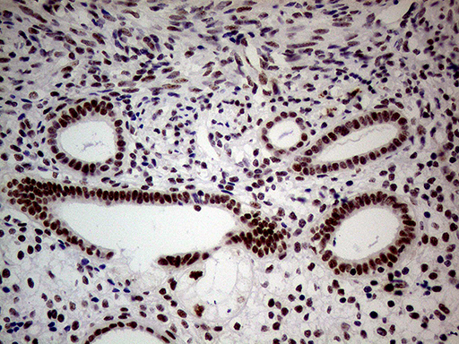 NSD3 / WHSC1L1 Antibody - Immunohistochemical staining of paraffin-embedded Human endometrium tissue within the normal limits using anti-WHSC1L1 mouse monoclonal antibody. (Heat-induced epitope retrieval by 1mM EDTA in 10mM Tris buffer. (pH8.5) at 120°C for 3 min. (1:500)