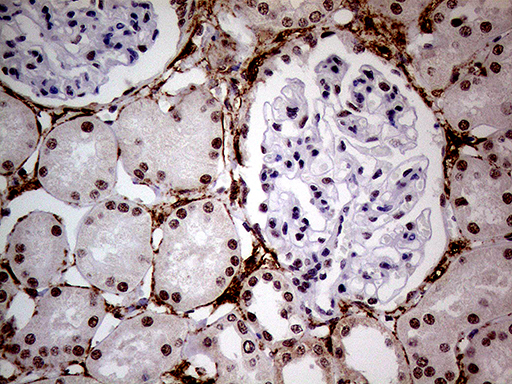 NSD3 / WHSC1L1 Antibody - Immunohistochemical staining of paraffin-embedded Human Kidney tissue within the normal limits using anti-WHSC1L1 mouse monoclonal antibody. (Heat-induced epitope retrieval by 1mM EDTA in 10mM Tris buffer. (pH8.5) at 120°C for 3 min. (1:500)