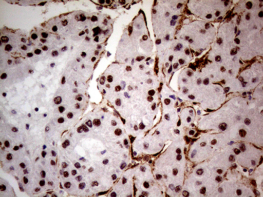 NSD3 / WHSC1L1 Antibody - Immunohistochemical staining of paraffin-embedded Human liver tissue within the normal limits using anti-WHSC1L1 mouse monoclonal antibody. (Heat-induced epitope retrieval by 1mM EDTA in 10mM Tris buffer. (pH8.5) at 120°C for 3 min. (1:500)