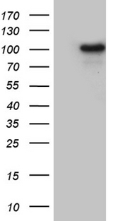 NSD3 / WHSC1L1 Antibody - HEK293T cells were transfected with the pCMV6-ENTRY control. (Left lane) or pCMV6-ENTRY WHSC1L1. (Right lane) cDNA for 48 hrs and lysed. Equivalent amounts of cell lysates. (5 ug per lane) were separated by SDS-PAGE and immunoblotted with anti-WHSC1L1. (1:2000)