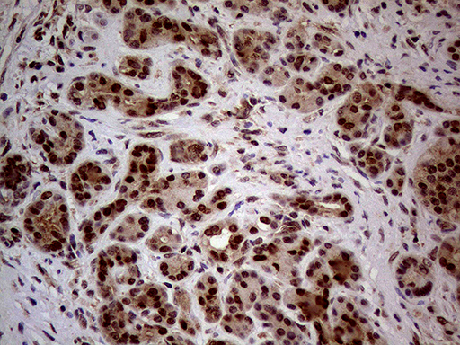 NSD3 / WHSC1L1 Antibody - Immunohistochemical staining of paraffin-embedded Human pancreas tissue within the normal limits using anti-WHSC1L1 mouse monoclonal antibody. (Heat-induced epitope retrieval by 1mM EDTA in 10mM Tris buffer. (pH8.5) at 120°C for 3 min. (1:500)