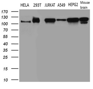 NSD3 / WHSC1L1 Antibody - Western blot analysis of extracts. (35ug) from 5 different cell lines and 1 tissue lysate by using anti-WHSC1L1 monoclonal antibody. (1:500)